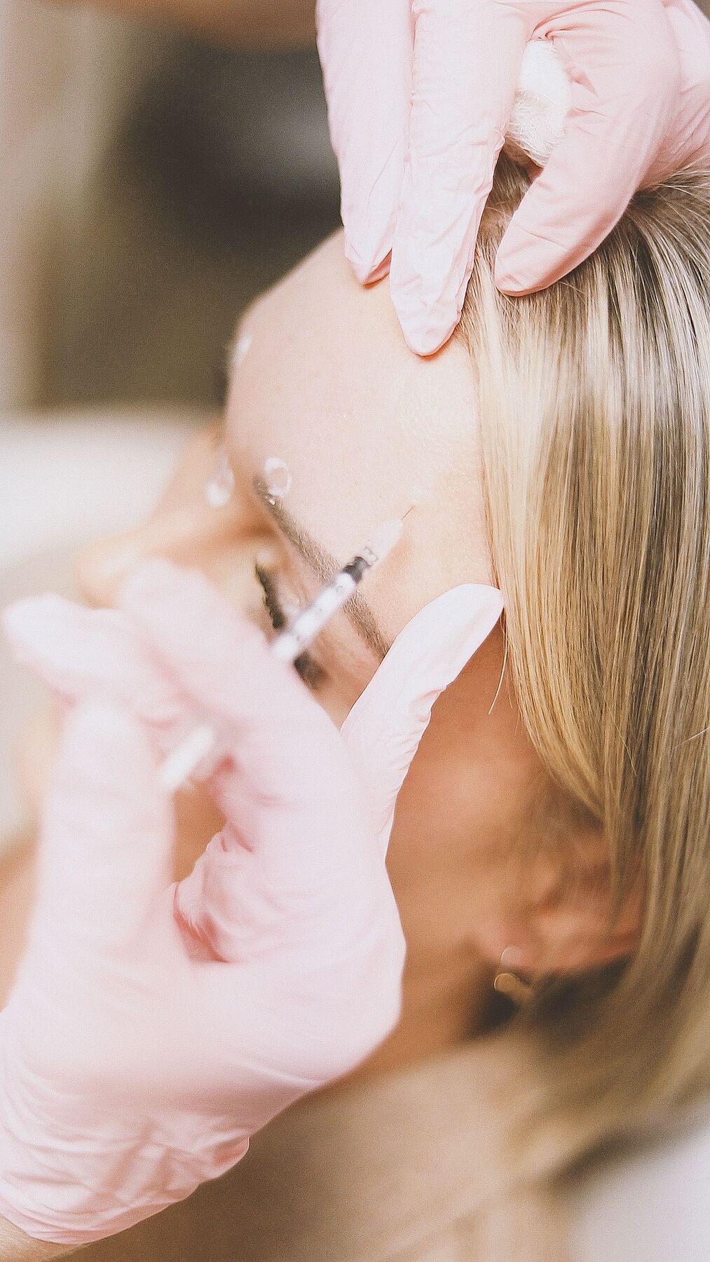 Anti-Wrinkle Injections — treatment image